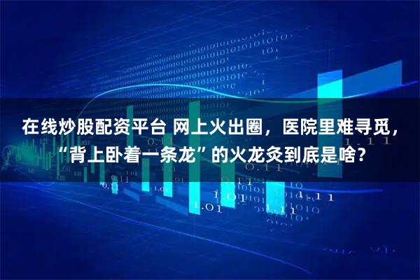 在线炒股配资平台 网上火出圈，医院里难寻觅，“背上卧着一条龙”的火龙灸到底是啥？